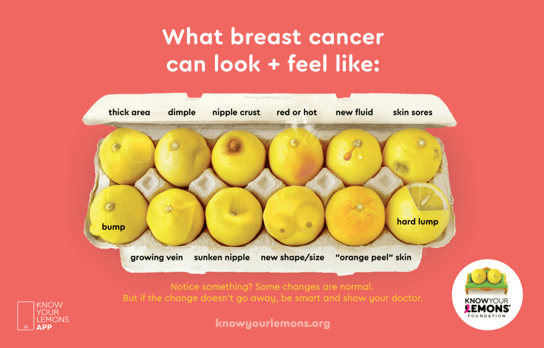 image of an egg carton full of lemons to illustrate different breast cancer warning signs on the lemons